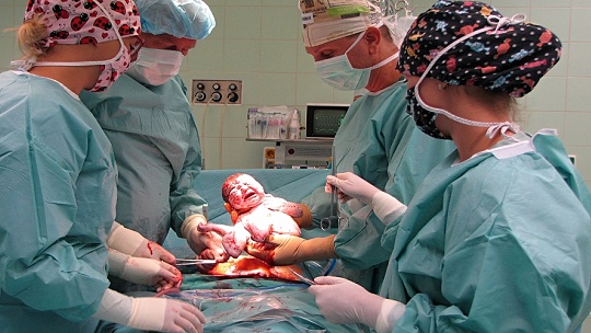 Obrázok Veľký úspech. Lenke operovali v martinskej nemocnici placentu vrastenú do maternice