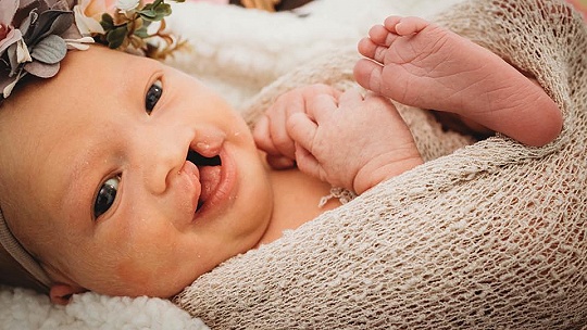 Obrázok FOTO Aj dieťa s rázštepom pery je nádherné! Malá Christian hviezdou internetu