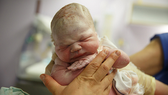 Obrázok Pôrody po slovensky. Každé tretie tehotenstvo končí cisárskym rezom, najviac detí sa rodí ženám vo veku 25 až 29 rokov