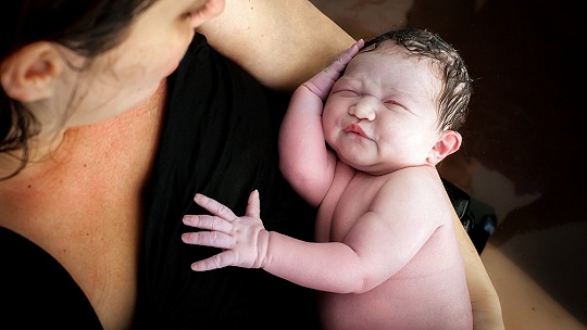 Obrázok Žiadnu paniku, nesúmerná hlávka novorodencov neznamená hneď problém