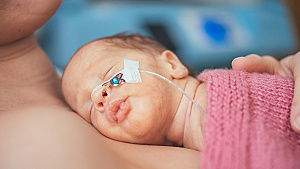 Obrázok Pampers a OZ Malíček opäť pomáhajú predčasniatkam