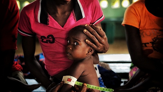 Obrázok Na podvýživu ročne zomrie 3,5 milióna detí