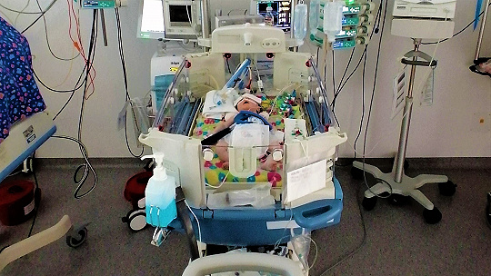 Obrázok Nemocnica zachraňuje novorodencov cieleným podchladením