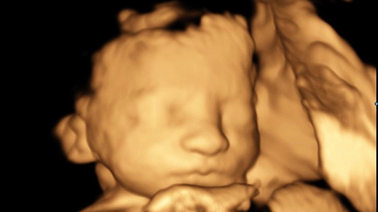 Obrázok Unikátne odhalenia: Čo všetko vníma dieťa v maternici ešte pred narodením a aký vplyv na jeho psychiku má citové rozpoloženie matky?