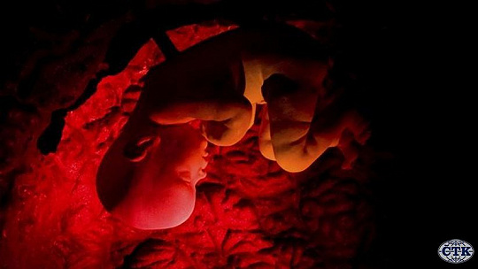 Obrázok Zaujímavosť. V USA sa narodili dvojčatá z embryí zmrazených pred vyše 30 rokmi, vzali si ich adoptívni rodičia