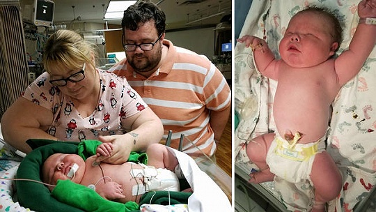 Obrázok V USA sa narodil chlapec s váhou 6,7 kilogramu. Na svet prišiel cisárskym rezom